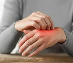 Allergy Control Treatmnet